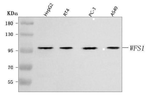 Anti-WFS1 Antibody Picoband® Boster Bio