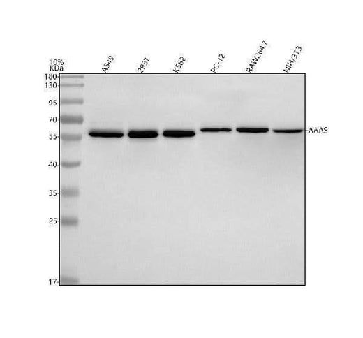 Anti-ALADIN/AAAS Antibody Picoband® Boster Bio