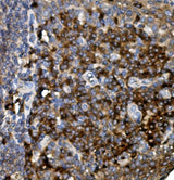Anti-CD74 Antibody Boster Bio