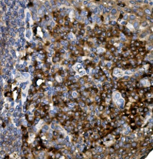 Anti-CD74 Antibody Boster Bio