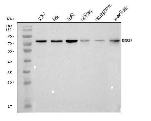 Anti-GPR54/KISS1R Antibody Picoband® Boster Bio