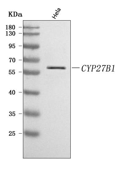 Anti-CYP27B1 Antibody Picoband® Boster Bio