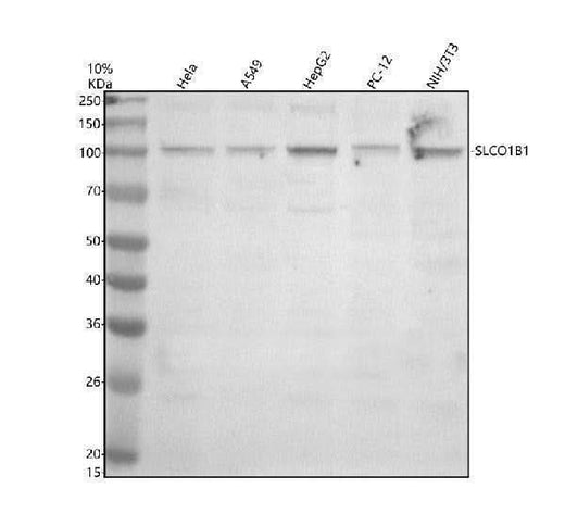 Anti-SLCO1B1 Antibody Picoband® Boster Bio