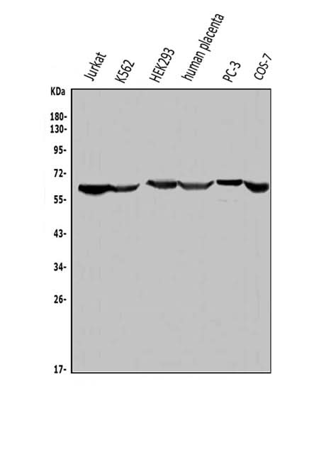 Anti-ME2 Antibody Picoband® Boster Bio