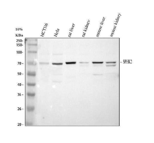 Anti-SPHK2 Antibody Picoband® Boster Bio