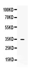 Anti-NAT1 Antibody Picoband® Boster Bio