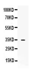 Anti-NAT1 Antibody Picoband® Boster Bio