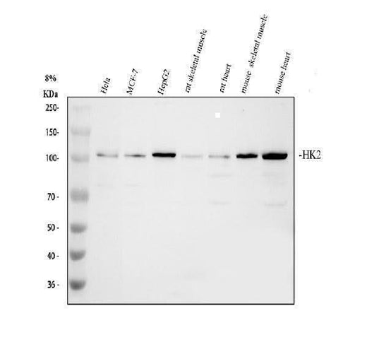 Anti-Hexokinase II/HK2 Antibody Picoband® Boster Bio