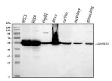 Anti-Retinal dehydrogenase 1 ALDH1A1 Antibody Picoband® Boster Bio
