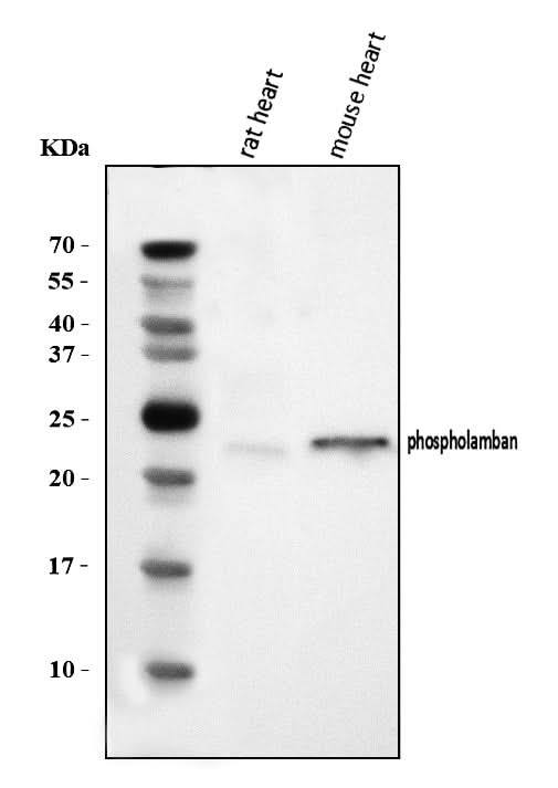 Anti-Phospholamban/PLN Antibody Picoband® Boster Bio
