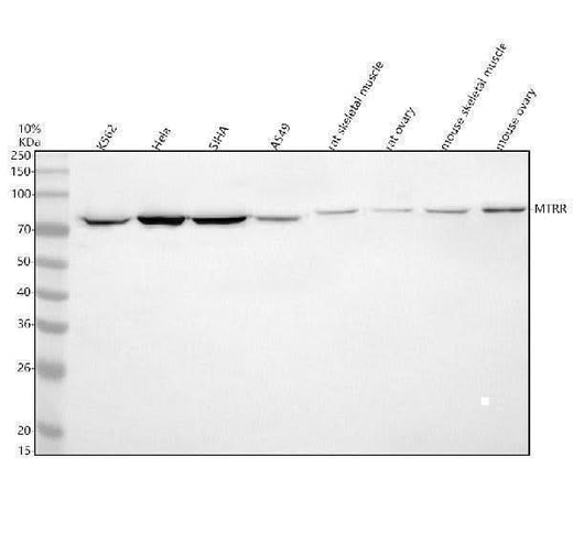 Anti-MTRR Antibody Picoband® Boster Bio