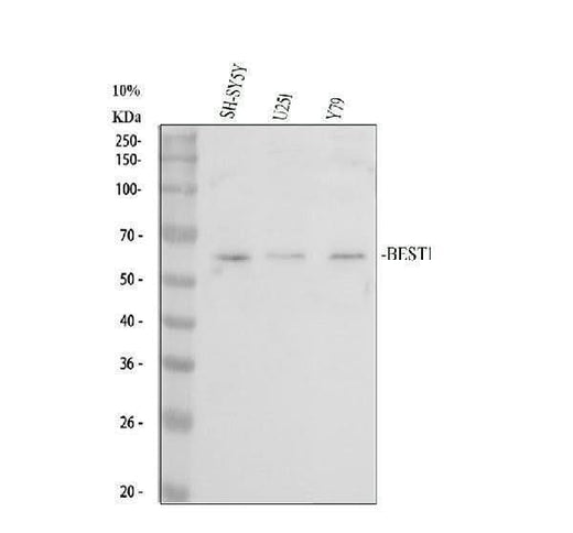 Anti-Bestrophin/BEST1 Antibody Picoband® Boster Bio