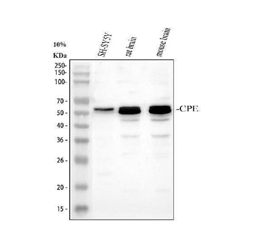 Anti-Carboxypeptidase E/CPE Antibody Picoband® Boster Bio