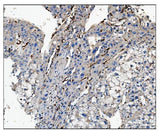 Anti-CD16/FCGR3A Antibody Boster Bio