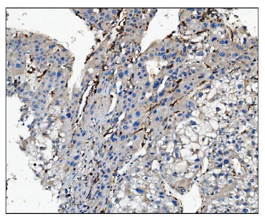 Anti-CD16/FCGR3A Antibody Boster Bio