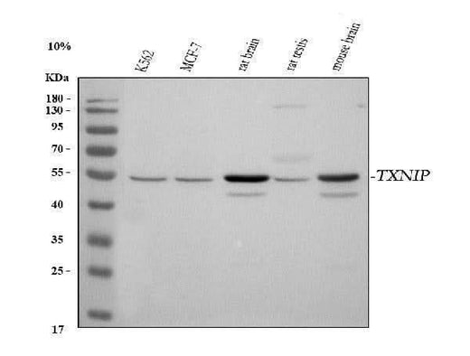 Anti-TXNIP Antibody Picoband® Boster Bio