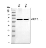 Anti-CARD9 Picoband® Antibody Boster Bio