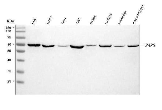 Anti-RARS/RARS1 Antibody Picoband® Boster Bio