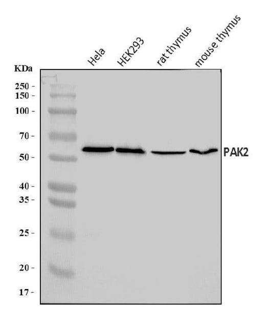 Anti-PAK2 Antibody Picoband® Boster Bio