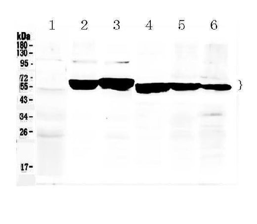 Anti-Cytokeratin 8/KRT8 Antibody Picoband® Boster Bio