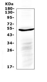 Anti-IL6R Antibody Picoband® Boster Bio