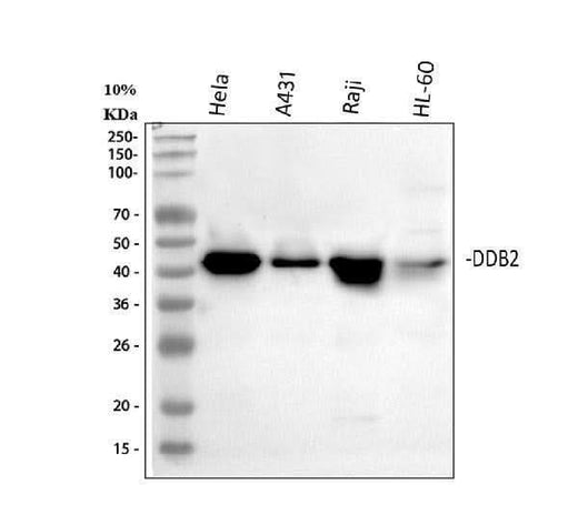 Anti-DDB2 Antibody Picoband® Boster Bio