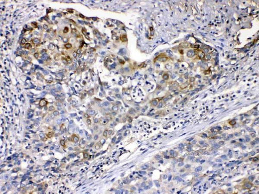 Anti-Cytokeratin 14/KRT14 Antibody Picoband® Boster Bio