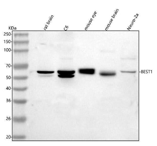 Anti-Bestrophin-1/Best1 Antibody Picoband® Boster Bio