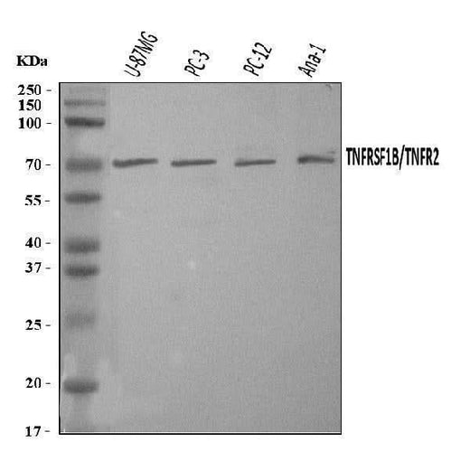 Anti-TNF Receptor II/TNFRSF1B Antibody Picoband® Boster Bio