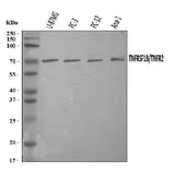 Anti-TNF Receptor II/TNFRSF1B Antibody Picoband® Boster Bio