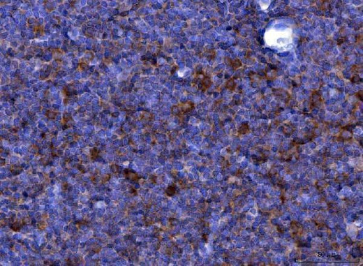 Anti-Eotaxin/Ccl11 Antibody Boster Bio