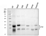 Anti-Cathepsin B/CTSB Antibody Picoband® Boster Bio