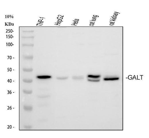 Anti-GALT Antibody Picoband® Boster Bio