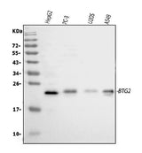 Anti-BTG2 Antibody Picoband® Boster Bio