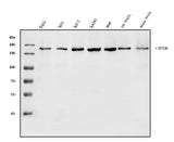 Anti-Raptor/RPTOR Antibody Picoband® Boster Bio