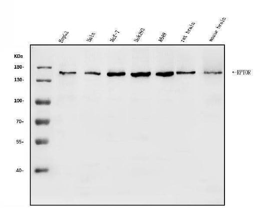 Anti-Raptor/RPTOR Antibody Picoband® Boster Bio
