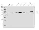 Anti-ALK-1/ACVRL1 Antibody Picoband® Boster Bio