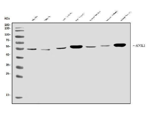 Anti-ALK-1/ACVRL1 Antibody Picoband® Boster Bio