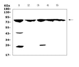 Anti-GRK2/GRK2 Antibody Picoband® Boster Bio