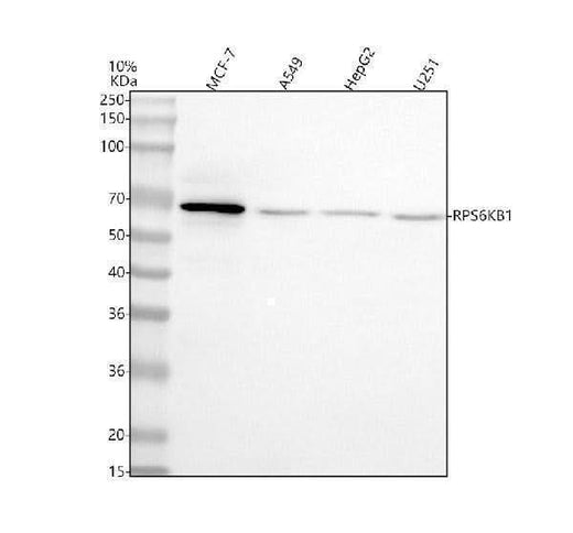 Anti-p70 S6K/RPS6KB1 Antibody Picoband® Boster Bio
