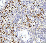 Anti-S100A12 Antibody Boster Bio
