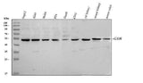 Anti-Glutathione Reductase/GSR Antibody Picoband® Boster Bio