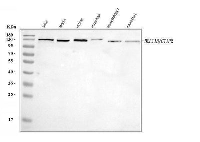 Anti-Ctip2/BCL11B Antibody Picoband® Boster Bio