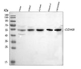 Anti-CDK8 Antibody Picoband® Boster Bio