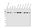 Anti-Hexokinase 1/HK1 Antibody Picoband® Boster Bio