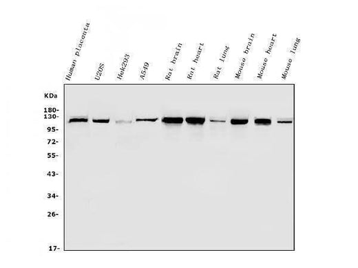 Anti-Hexokinase 1/HK1 Antibody Picoband® Boster Bio