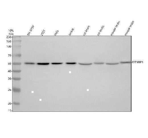 Anti-Dysbindin/DTNBP1 Antibody Picoband® Boster Bio
