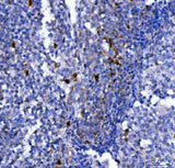 Anti-NCR1 Antibody Boster Bio