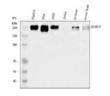 Anti-ROBO1 Antibody Picoband® Boster Bio