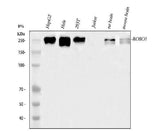 Anti-ROBO1 Antibody Picoband® Boster Bio